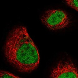 DCPS Antibody, Novus Biologicals 0.1mL; Unlabeled:Antibodies, Polyclonal